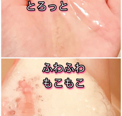 AHA·BHA·PHA 30デイズミラクルアクネボディクレンザー/SOME BY MI/ボディソープを使ったクチコミ(2枚目)