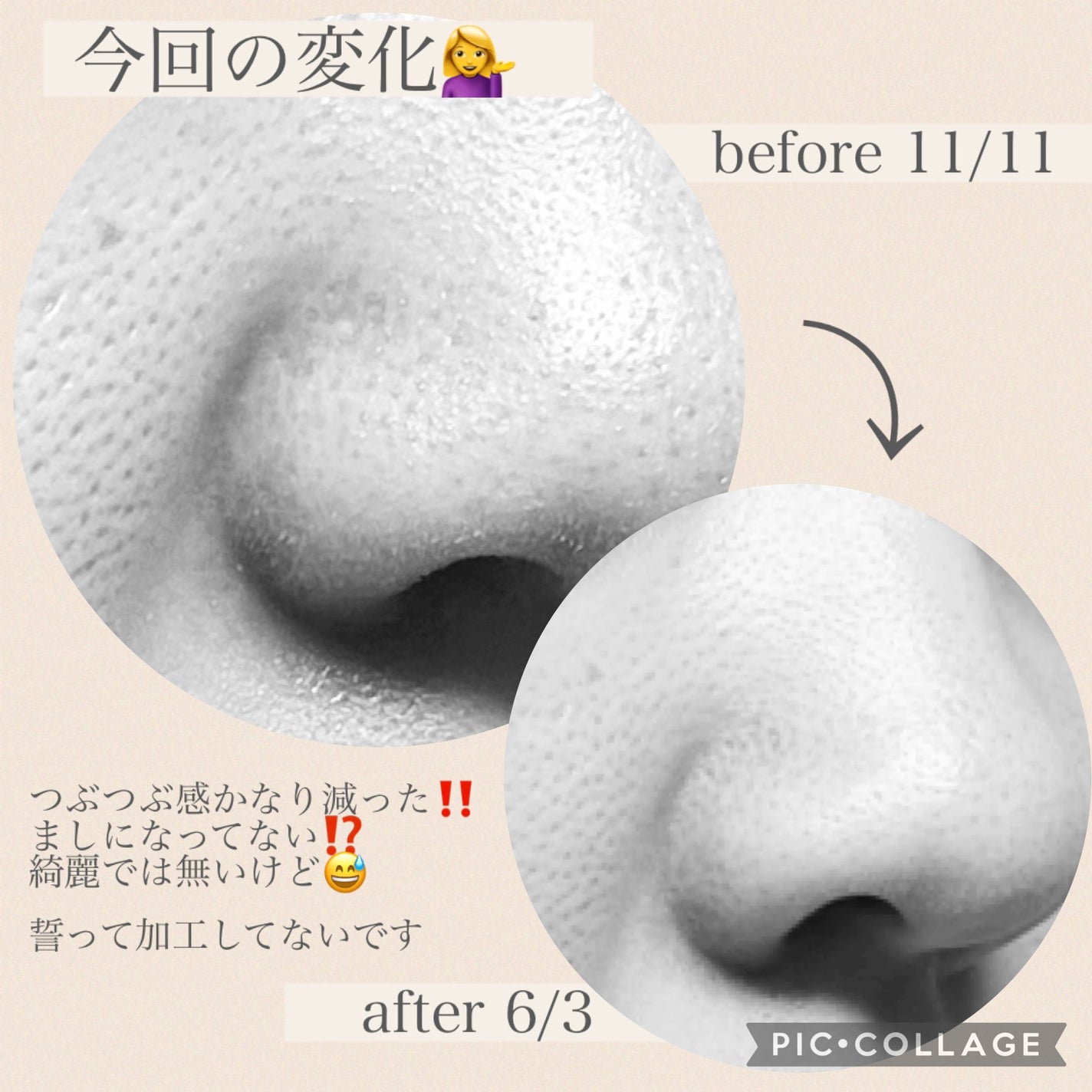 ケアセラ APフェイス&ボディ乳液/ケアセラ/ボディミルクを使ったクチコミ(4枚目)