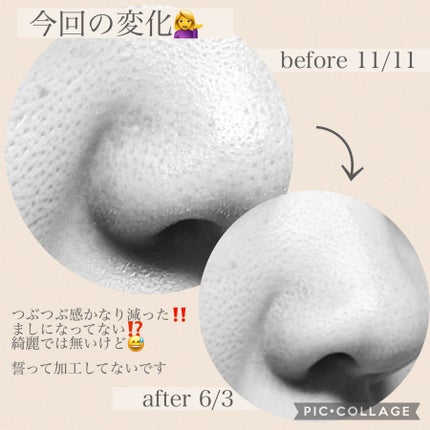 ケアセラ APフェイス&ボディ乳液/ケアセラ/ボディミルクを使ったクチコミ(4枚目)