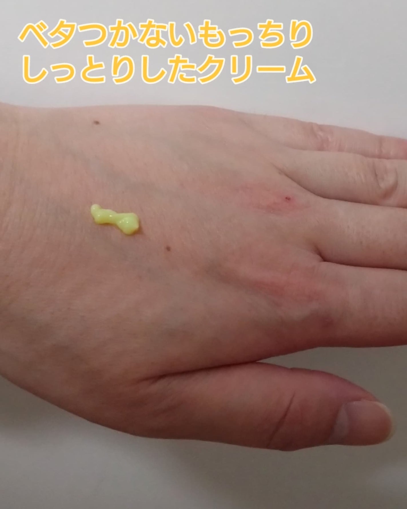 VITALIFT A forte/Dr.Different/フェイスクリームを使ったクチコミ(3枚目)