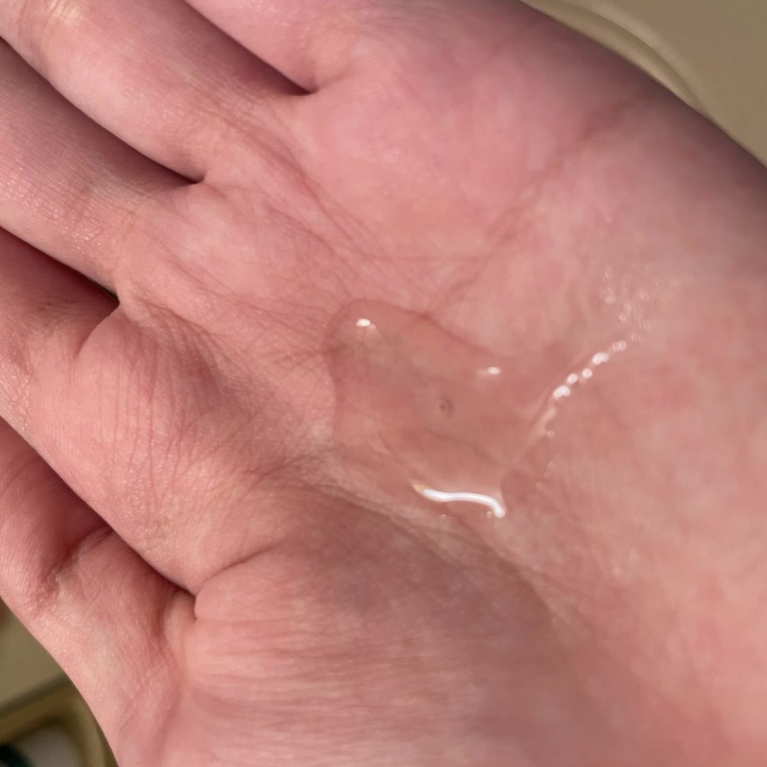 薬用 RJ地肌ケア エッセンス /アピセラピーコスメティクス/頭皮ローションを使ったクチコミ（2枚目）