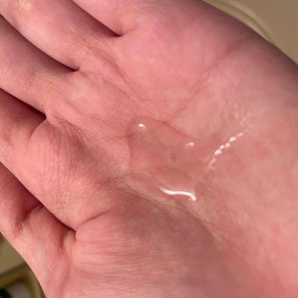 薬用 RJ地肌ケア エッセンス /アピセラピーコスメティクス/頭皮ローションを使ったクチコミ(2枚目)