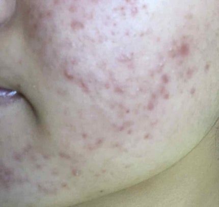 を使ったクチコミ(3枚目)