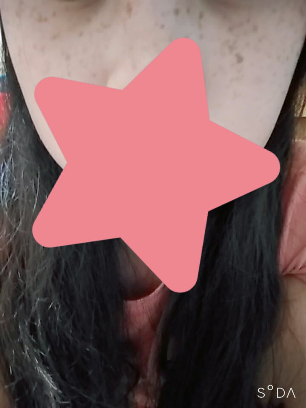 だおち on LIPS 「肌汚くてすんません。小さい頃から遺伝でそばかすが沢山あります。..」(1枚目)