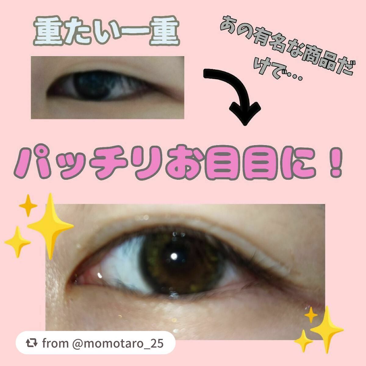 アイトーク/アイトーク/二重まぶた用アイテムを使ったクチコミ(1枚目)