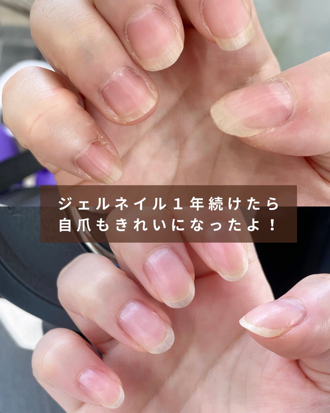 めがねちゃん👓フォロバ on LIPS 「手にコンプレックスのある人、このネイル試してみて!!💅私の手の..」(10枚目)