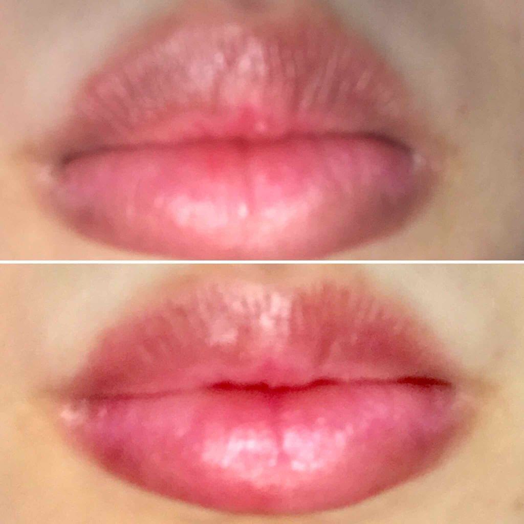 【旧】ディオール アディクト リップ グロウ 005 ライラック/Dior/リップケアを使ったクチコミ（2枚目）