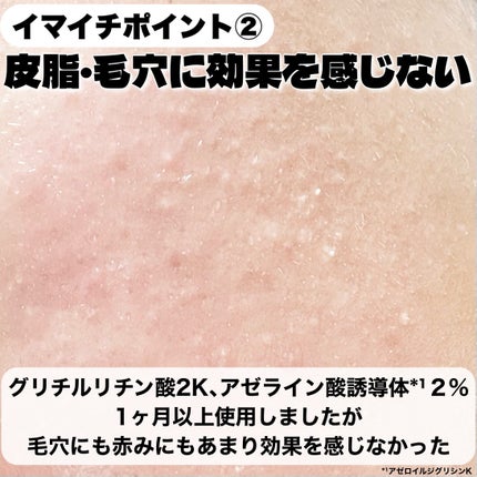 バランシングGAローション/TOUT VERT/化粧水を使ったクチコミ(4枚目)