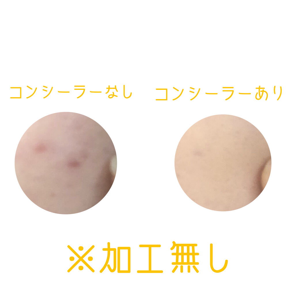 スポッツカバー ファウンデイション/SHISEIDO/クリームコンシーラーを使ったクチコミ（3枚目）