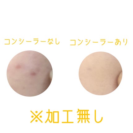 スポッツカバー ファウンデイション/SHISEIDO/クリームコンシーラーを使ったクチコミ(3枚目)