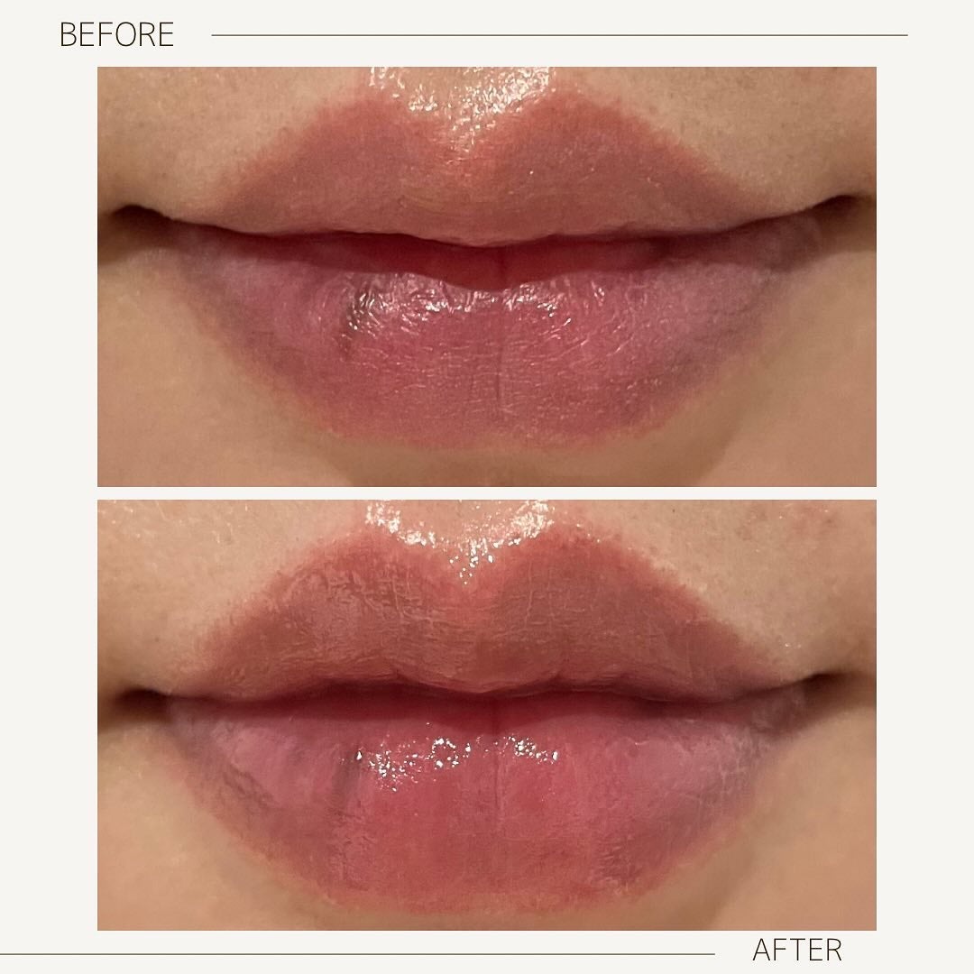 ラビューム ボリュームリップセラム/Luvum/リップグロスを使ったクチコミ(5枚目)