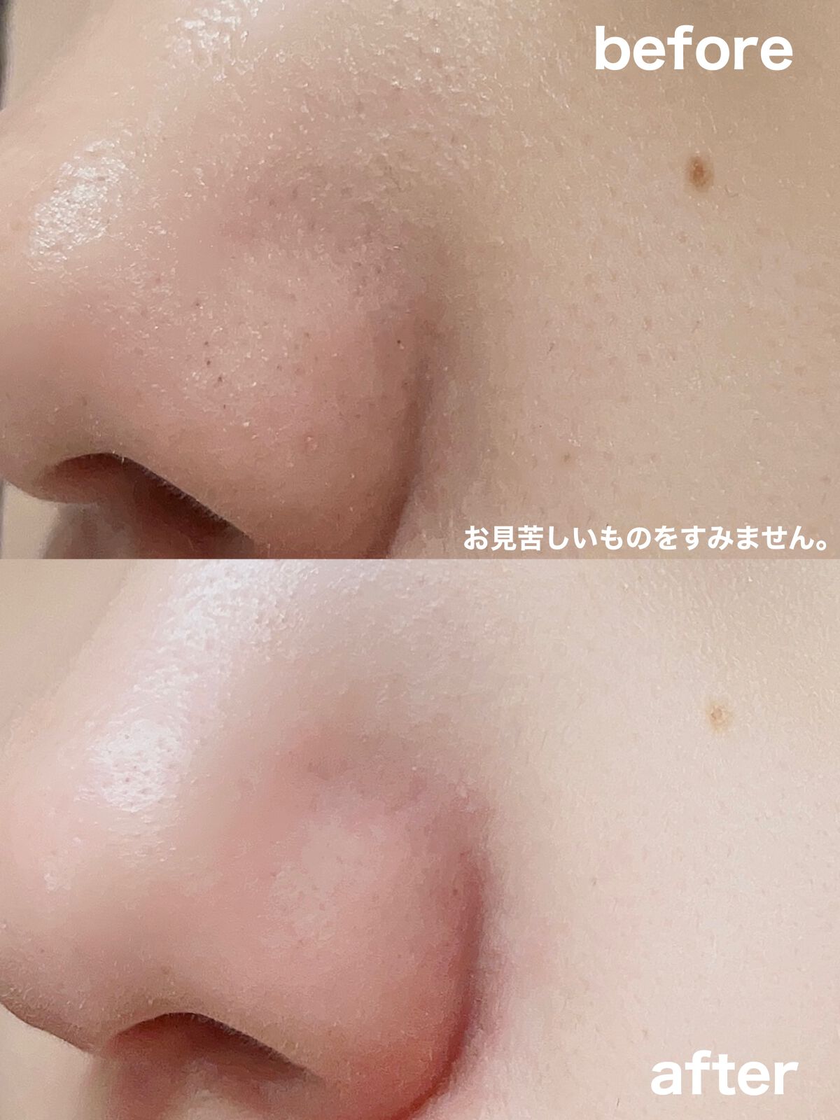 ベビーオイルR/ピジョン/ボディオイルを使ったクチコミ（3枚目）