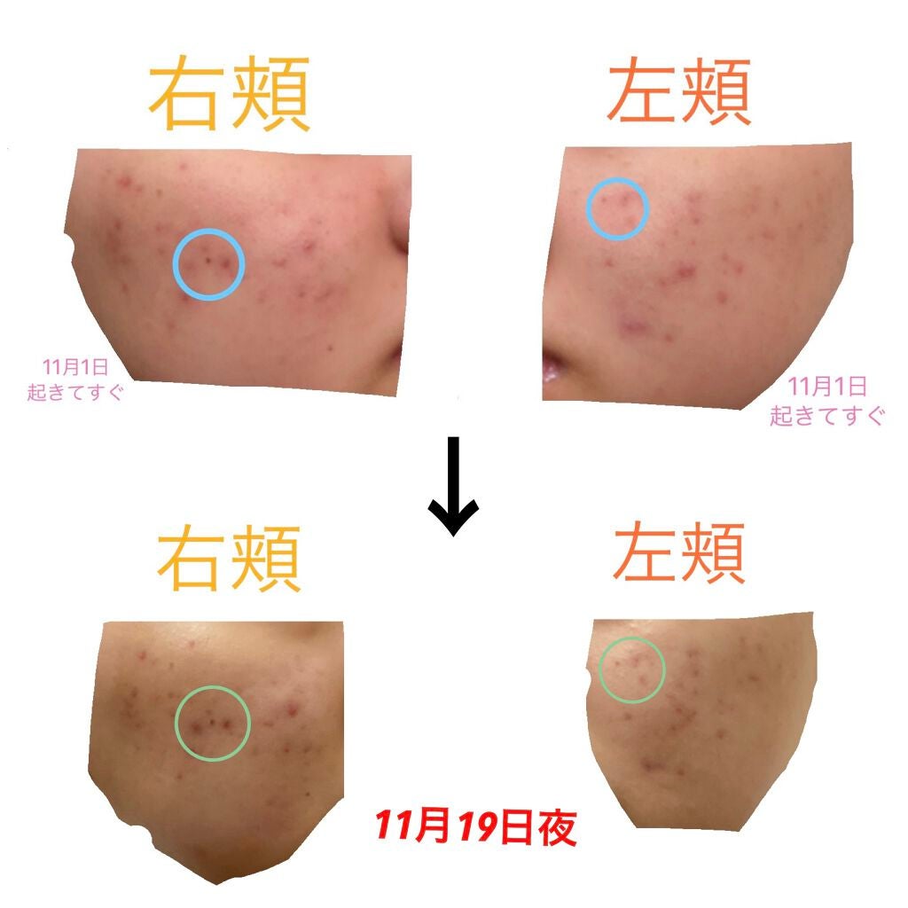 ハトムギ化粧水(ナチュリエ スキンコンディショナー R )/ナチュリエ/化粧水を使ったクチコミ(2枚目)