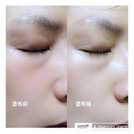 PHセンシティブスポットクリーム/SAM'U/フェイスクリームを使ったクチコミ(4枚目)