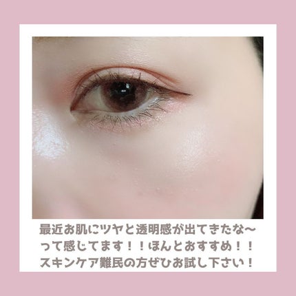 モーニング サプライズ インテンスケア ガラクトミセス ファースト エッセンス 94.5%/MORNING SURPRISE/ブースター・導入液を使ったクチコミ(7枚目)