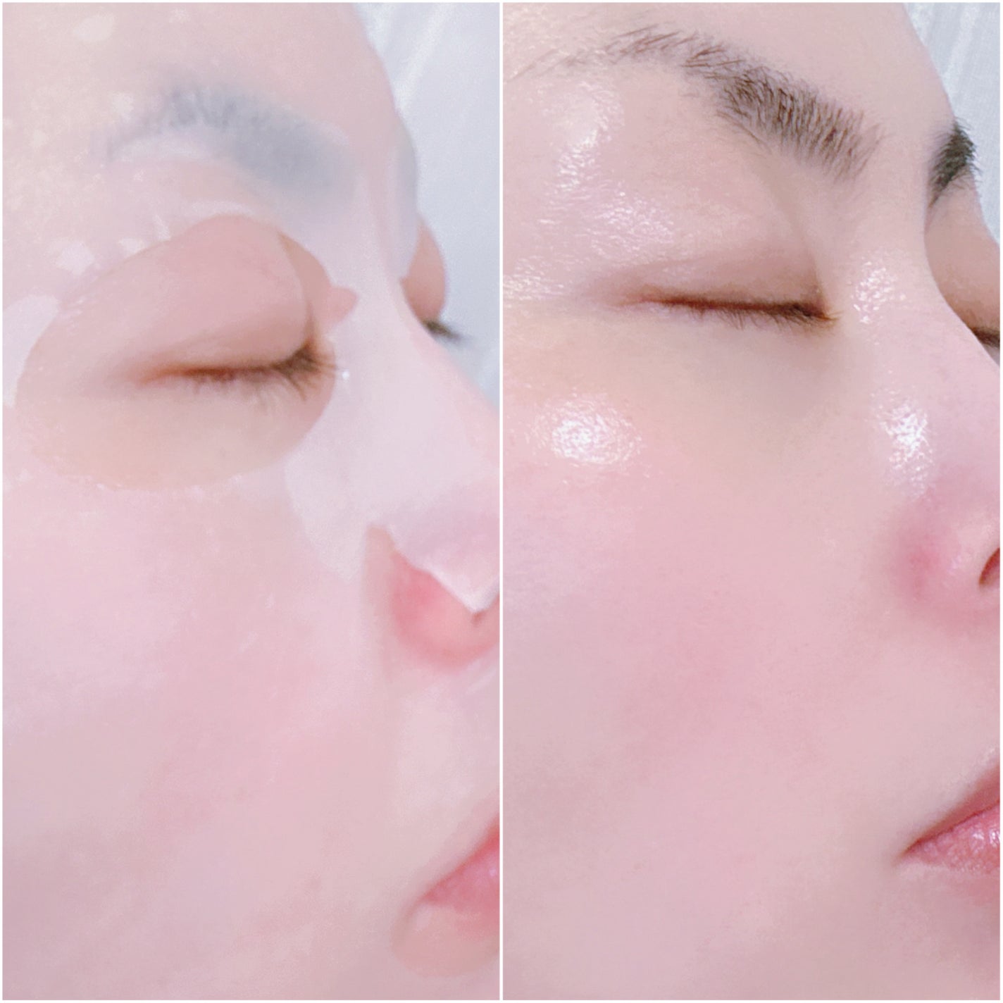 スノーグロウ/メディタミン/シートマスク・パックを使ったクチコミ(5枚目)