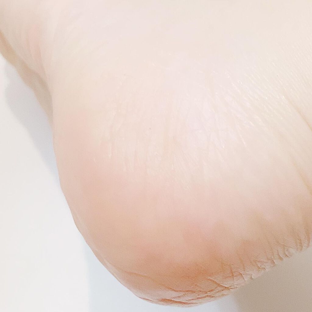 ノルウェー フォーミュラ インテンスリペア ボディ エマルジョン/Neutrogena/ボディローションを使ったクチコミ(6枚目)