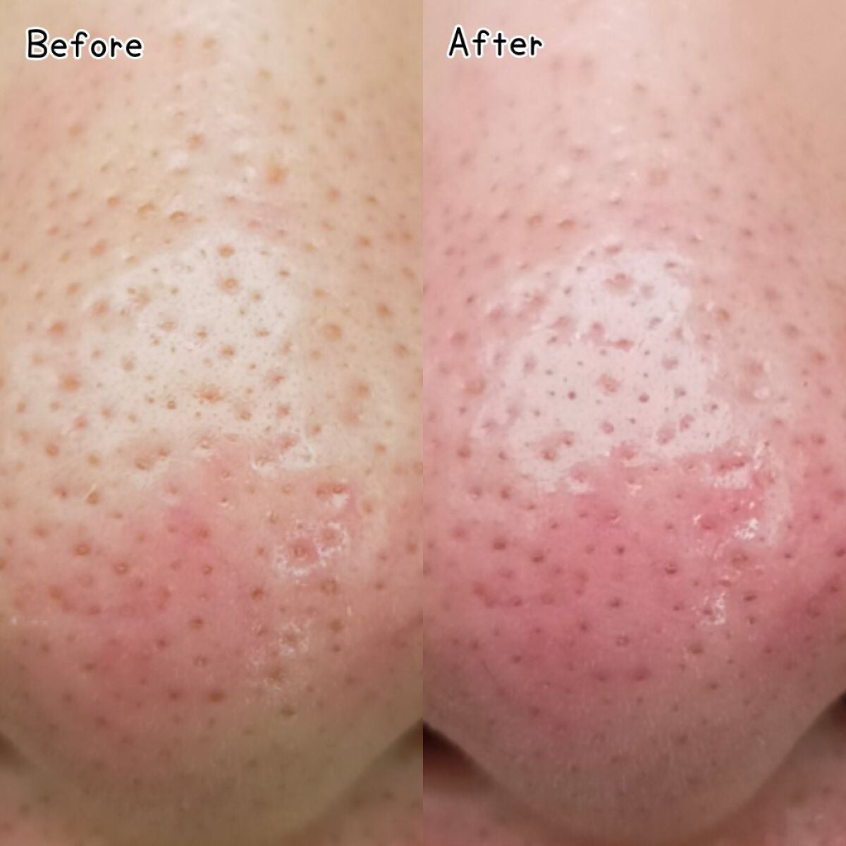 水クレンジング/なめらか本舗/クレンジングウォーターを使ったクチコミ(5枚目)