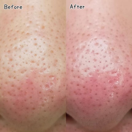 水クレンジング/なめらか本舗/クレンジングウォーターを使ったクチコミ(5枚目)