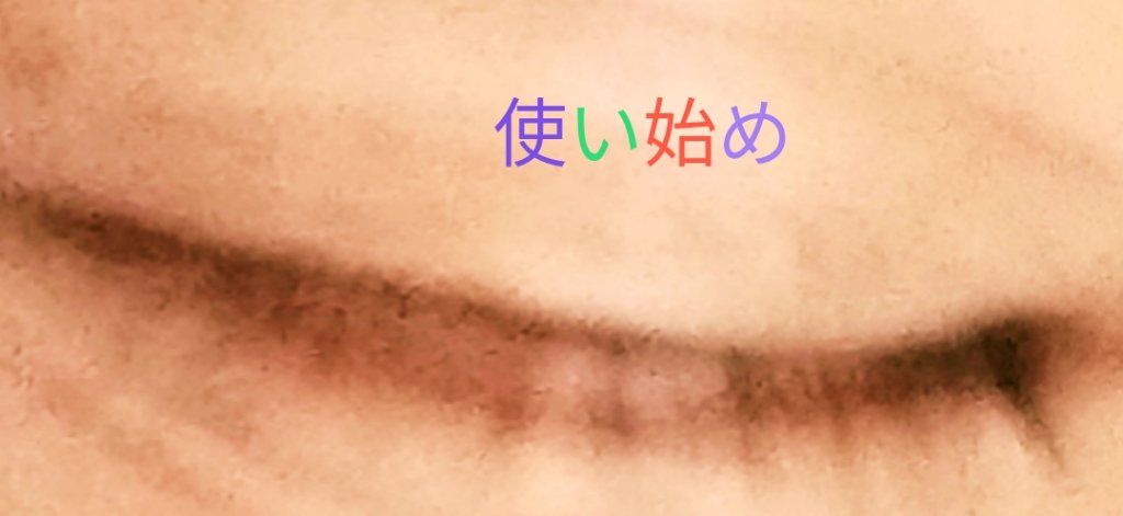 アイラッシュセラム/PHOEBE BEAUTY UP/まつげ美容液を使ったクチコミ（2枚目）