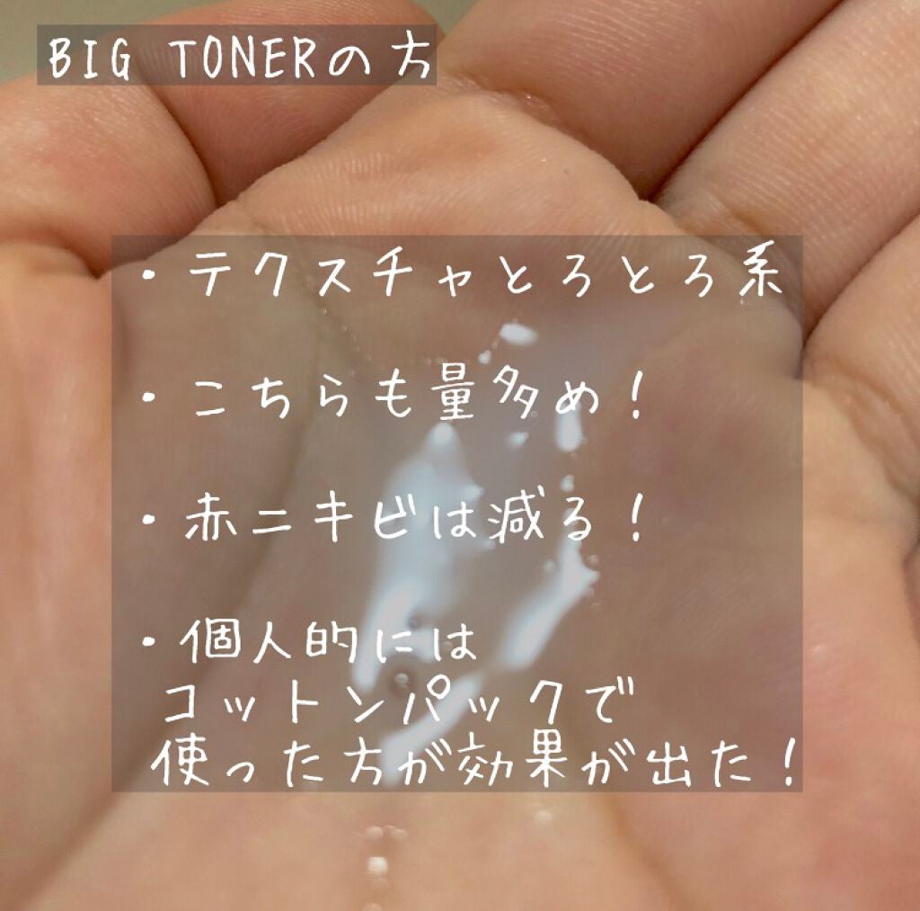 グリーン ダーマCICAビックトナー/ネイチャーリパブリック/化粧水を使ったクチコミ(5枚目)