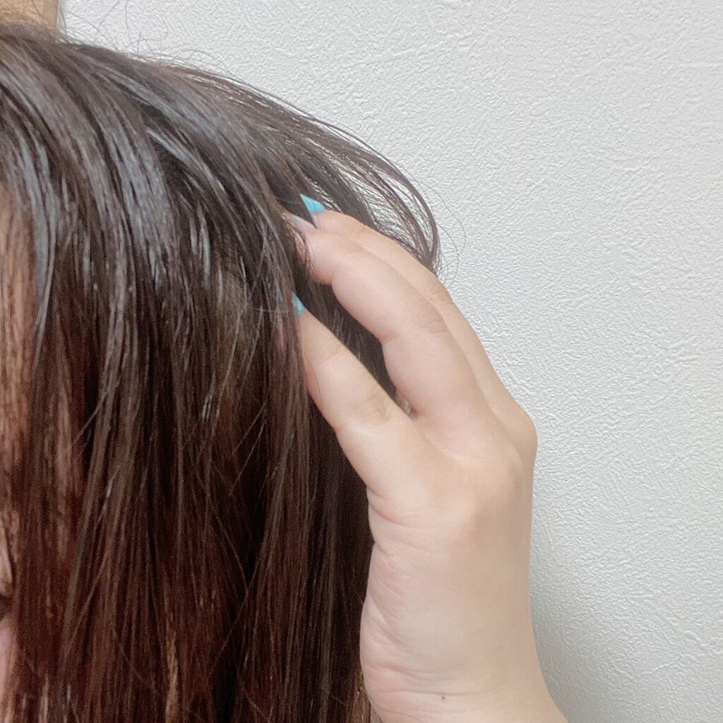 スカルプ リバイタライジングセラム/ヘア&スキン キメア/頭皮ローションを使ったクチコミ(7枚目)