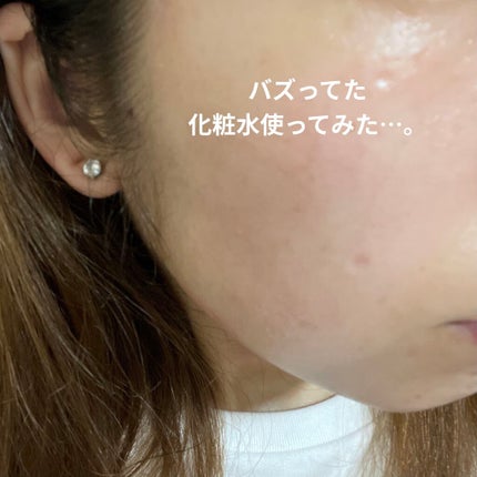 ツボクサ化粧水/ONE THING/化粧水を使ったクチコミ(1枚目)