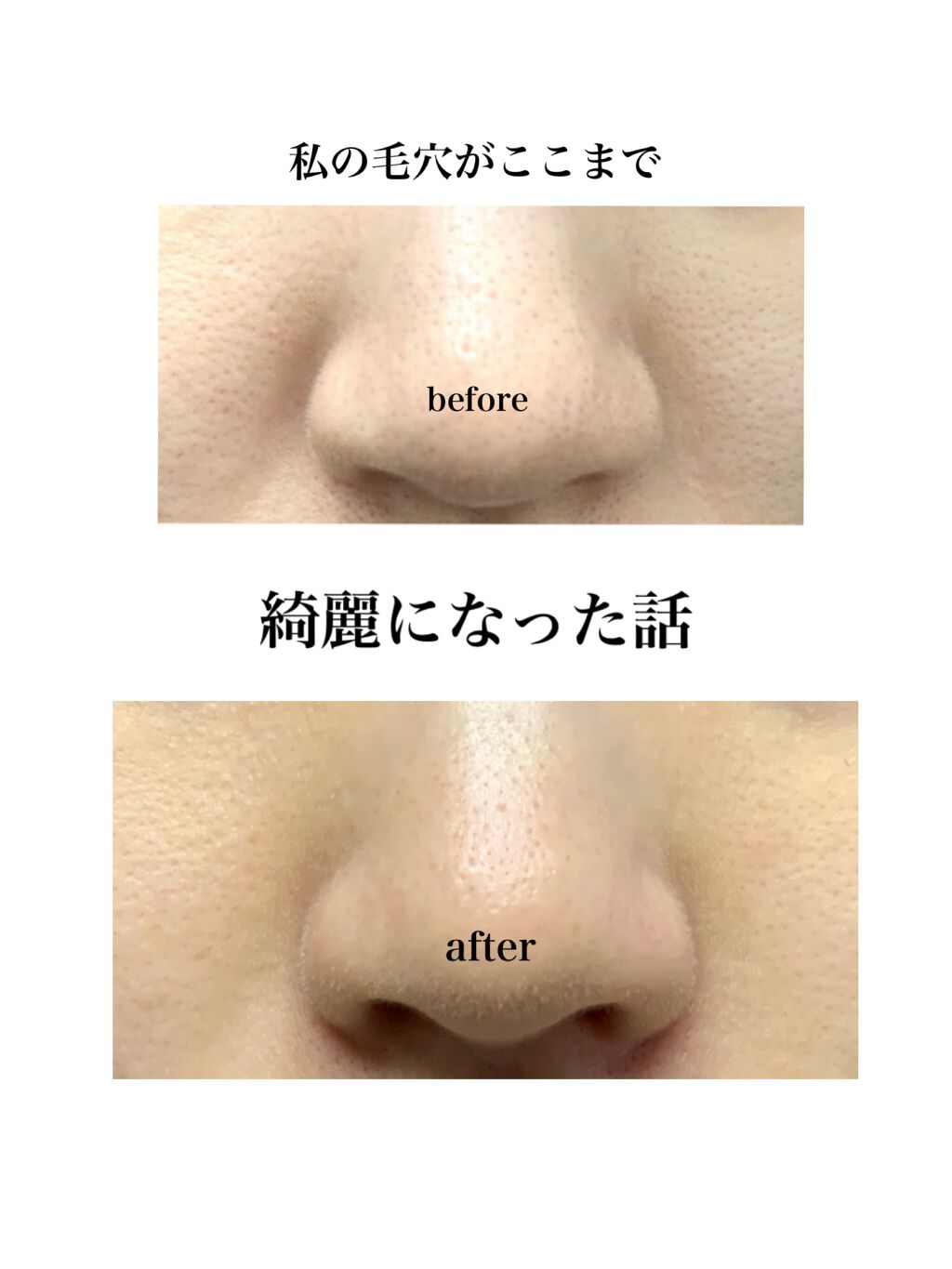 ソフティモ クリアプロ クレンジングバーム ディープクリア/ソフティモ/クレンジングバームを使ったクチコミ（1枚目）