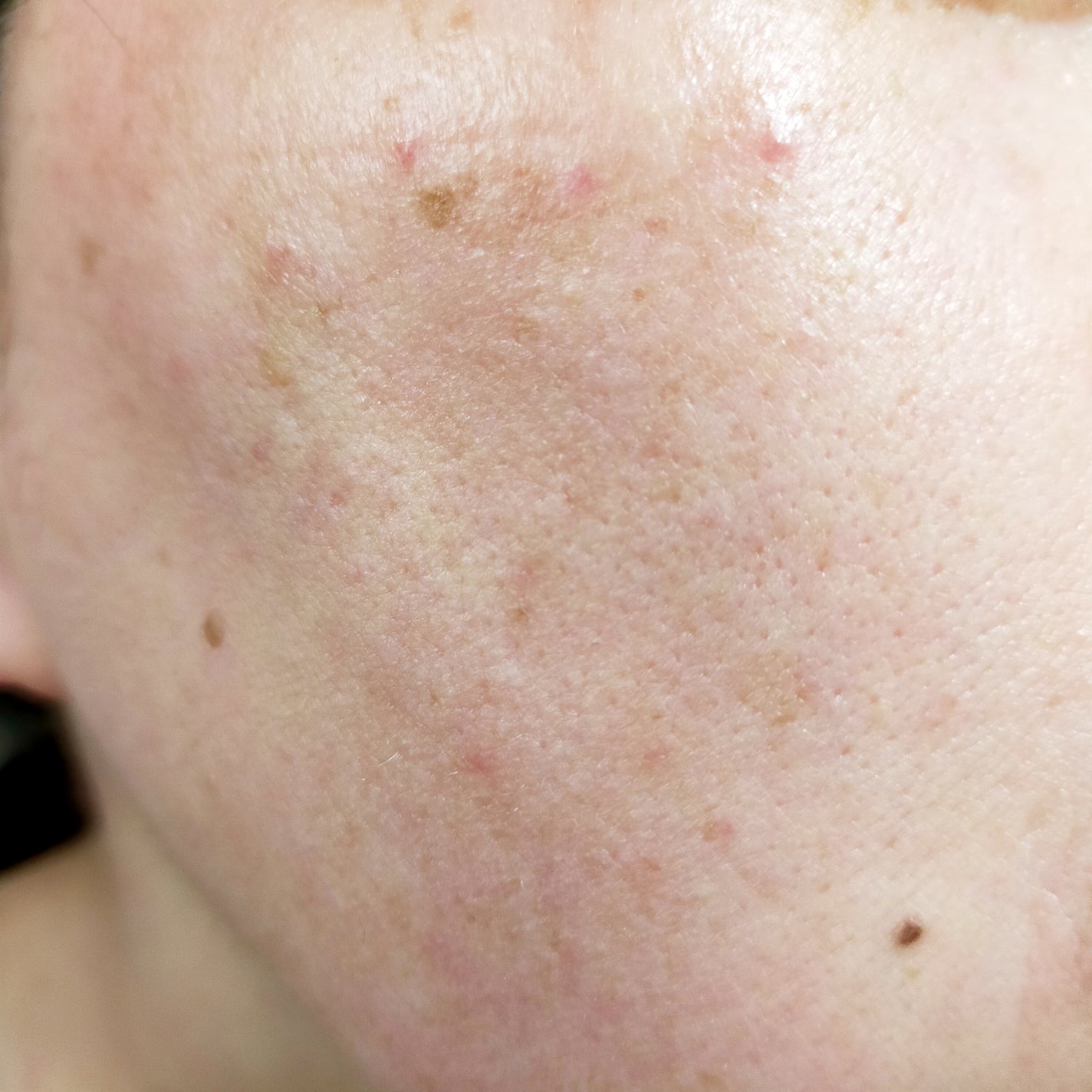 ルルルン ハイドラ V マスク/ルルルン/シートマスク・パックを使ったクチコミ(4枚目)