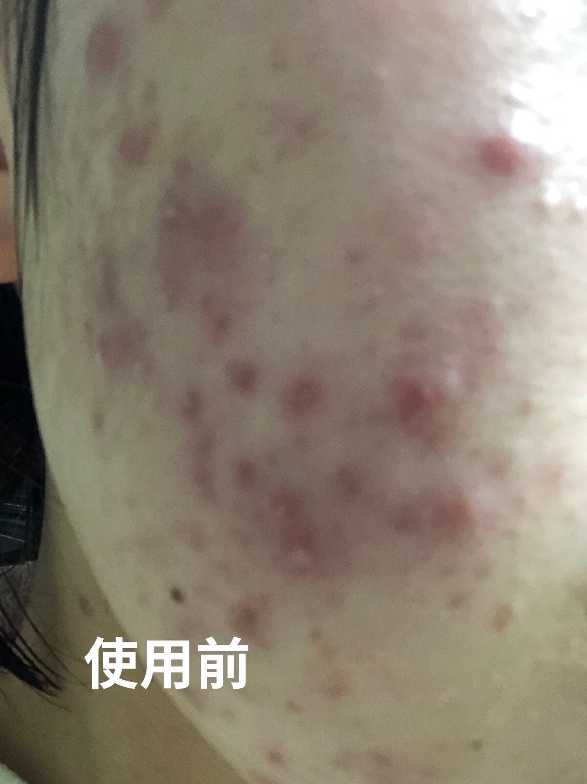 ドクダミ 77 スージングトナー/Anua/化粧水を使ったクチコミ(6枚目)