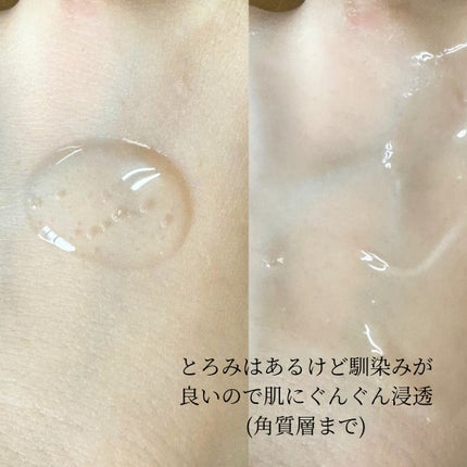 ミシャ タイムレボリューション レチ500ショット美容液/MISSHA/美容液を使ったクチコミ(3枚目)