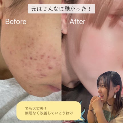 を使ったクチコミ(2枚目)