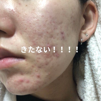 を使ったクチコミ(2枚目)