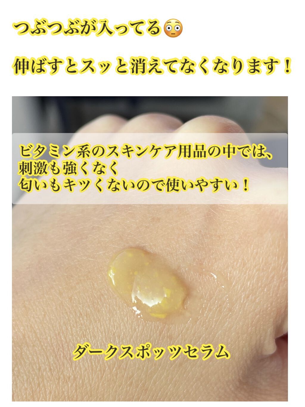 ビタペアC 集中美容液スペシャルセット/ネイチャーリパブリック/美容液を使ったクチコミ（2枚目）