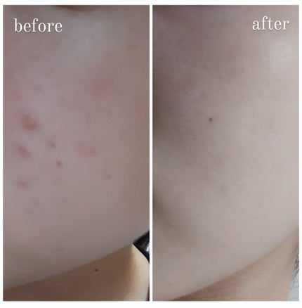 リセットクリアN/BENEFIQUE/化粧水を使ったクチコミ(2枚目)