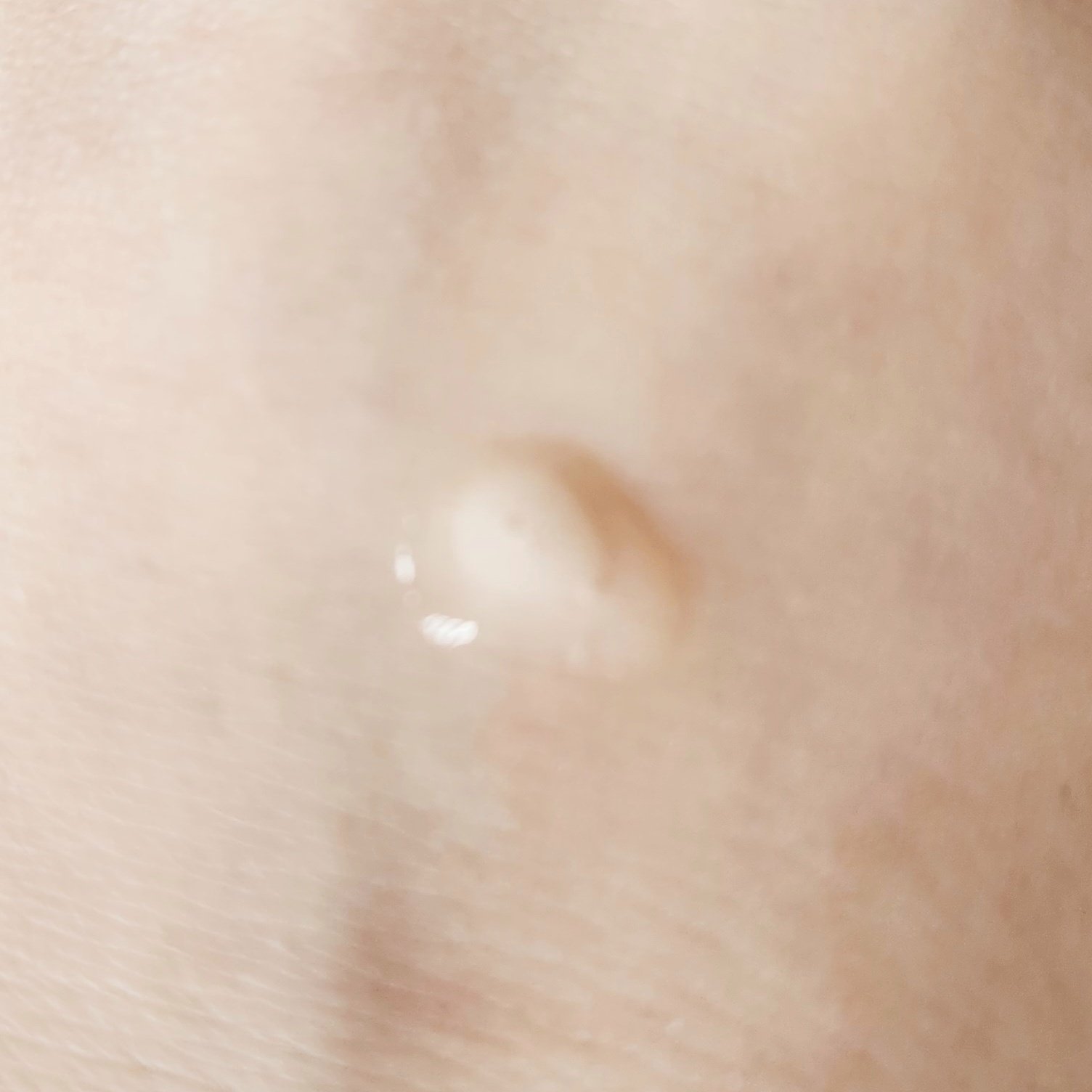 薬用スカルプエッセンス ファム/ELECTRON/頭皮ローションを使ったクチコミ（3枚目）