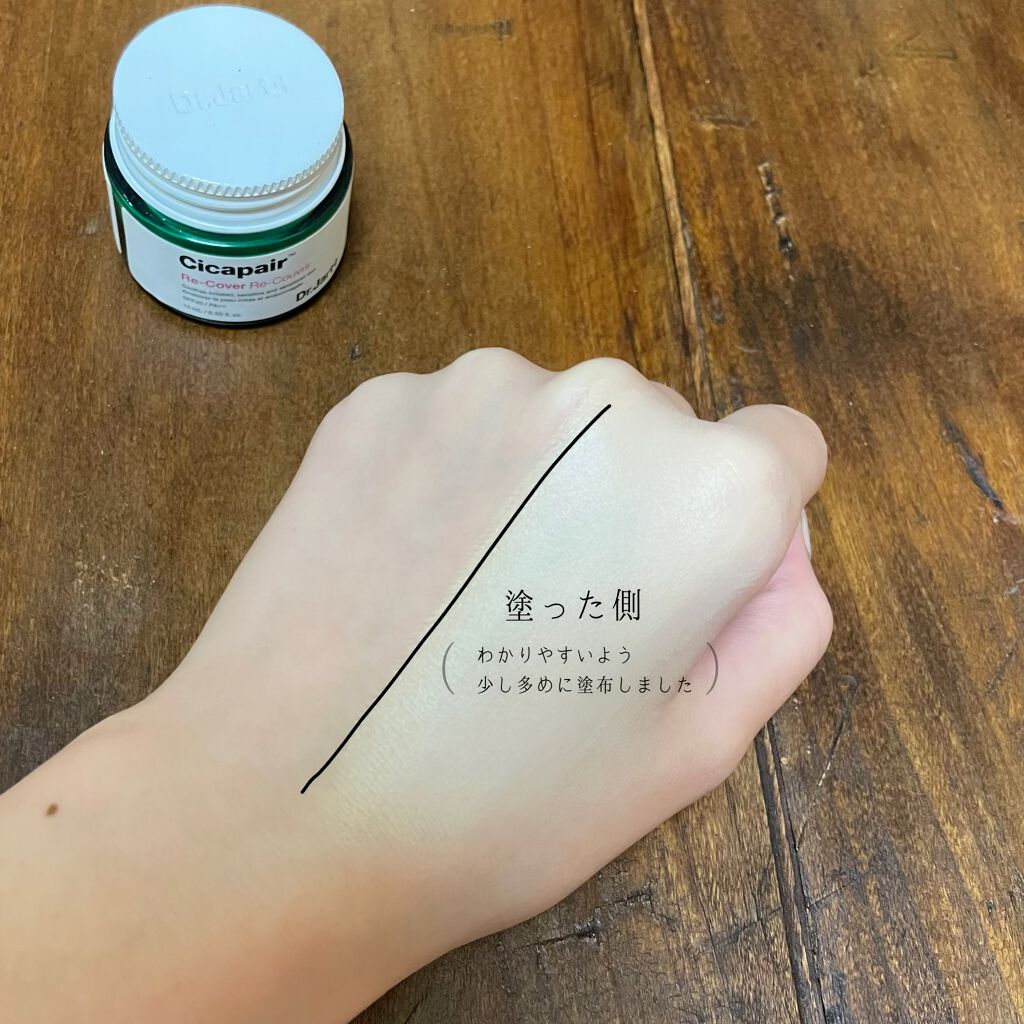 ドクタージャルト シカペア リカバー (第2世代）/Dr.Jart＋/フェイスクリームを使ったクチコミ（2枚目）