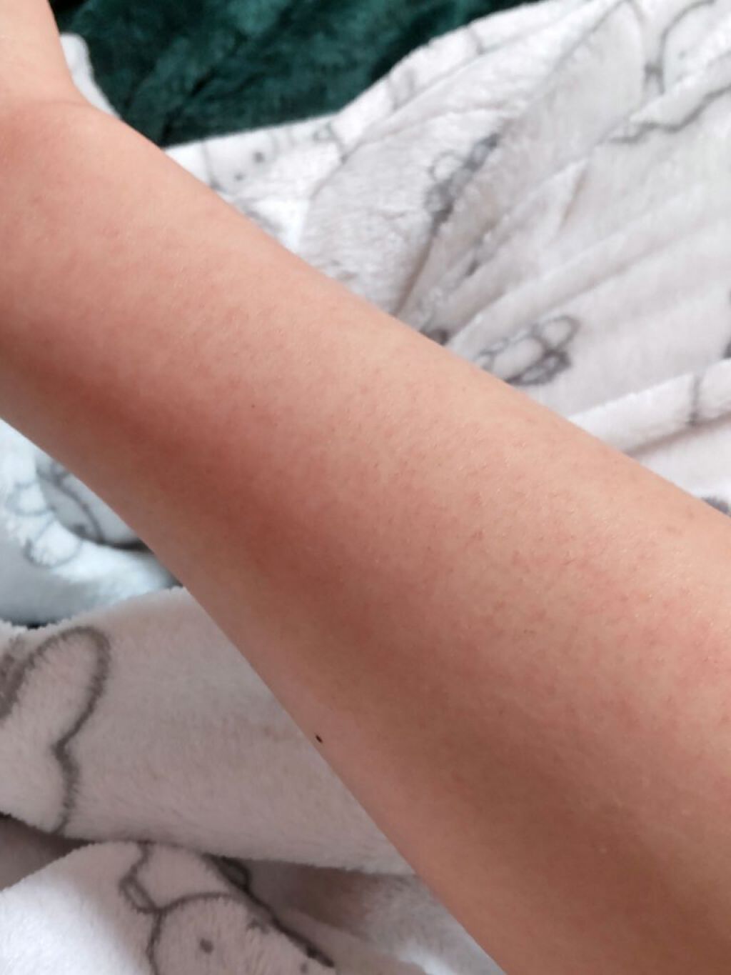 天然こんにゃくパフ/DAISO/その他スキンケアグッズを使ったクチコミ（3枚目）