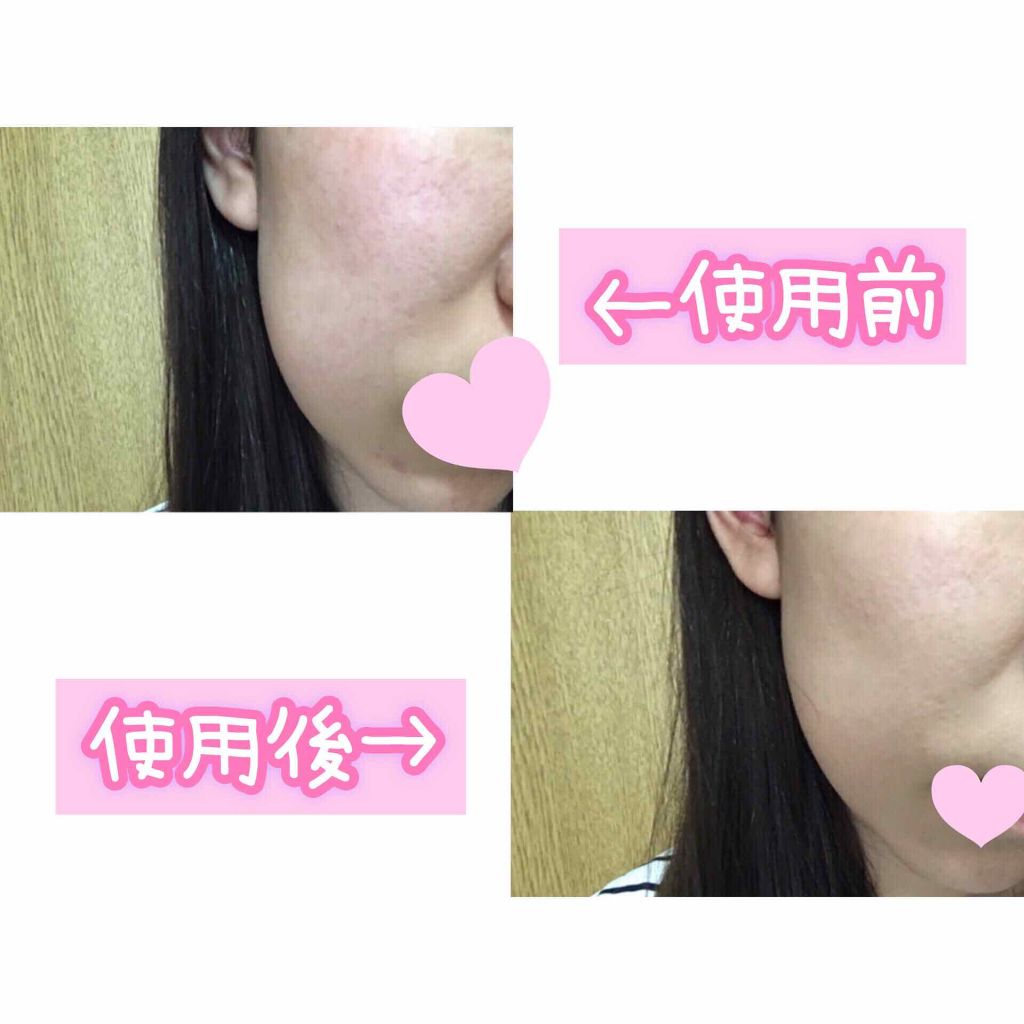 M クッション ファンデーション(モイスチャー)/MISSHA/クッションファンデーションを使ったクチコミ（3枚目）