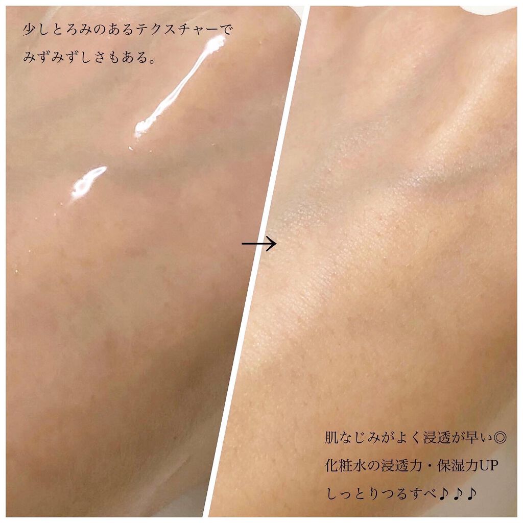 Rエッセンス/unlabel/美容液を使ったクチコミ(3枚目)