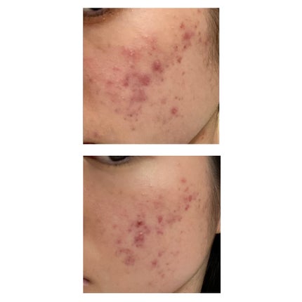 DHC ビタミンBミックス/DHC/美容サプリメントを使ったクチコミ(3枚目)