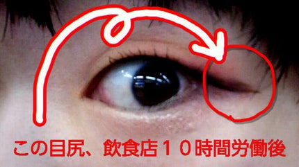 薬用ベビーパウダー/ピジョン/ボディパウダーを使ったクチコミ(1枚目)