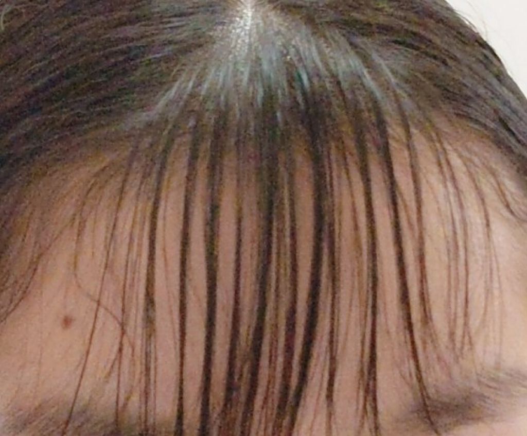 moeð°ðð on LIPS ããmoeð°ððã墿ããã¯ã±ãçããããã«ã¡ã¯ïŒmoeð°ððã§..ãïŒ2æç®ïŒ