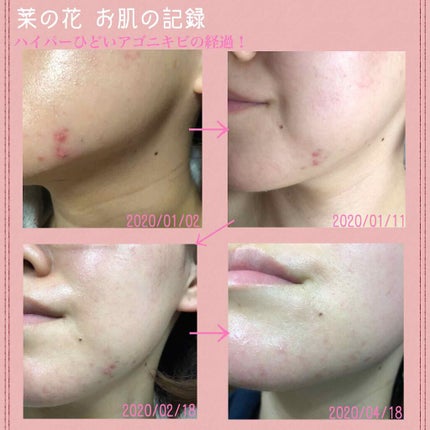 敏感肌用薬用美白美容液/無印良品/美容液を使ったクチコミ(2枚目)