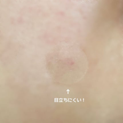 ごめんね素肌 キニナルマスク/クリアターン/シートマスク・パックを使ったクチコミ(5枚目)