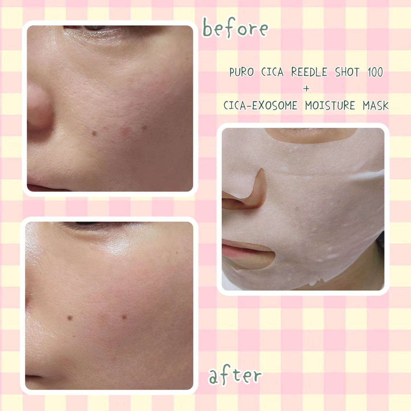 CICA エクソソーム モイスチャー マスク/VT/シートマスク・パックを使ったクチコミ(3枚目)