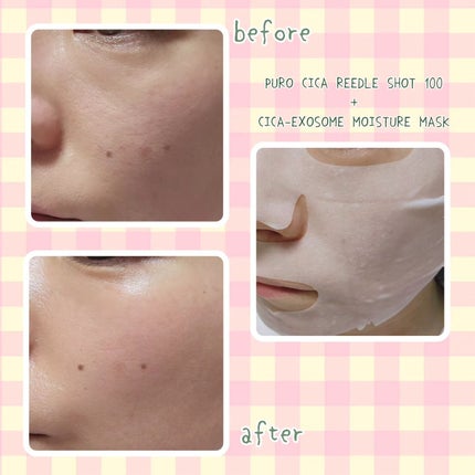 CICA エクソソーム モイスチャー マスク/VT/シートマスク・パックを使ったクチコミ(3枚目)