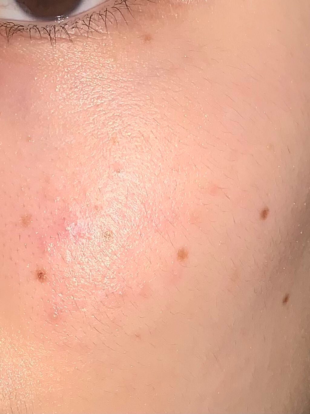 CICA ãã€ãªãŒã¹ãŒãžã³ã°ãã¹ã¯/VT/ã·ãŒããã¹ã¯ã»ããã¯ã䜿ã£ãã¯ãã³ãïŒ3æç®ïŒ