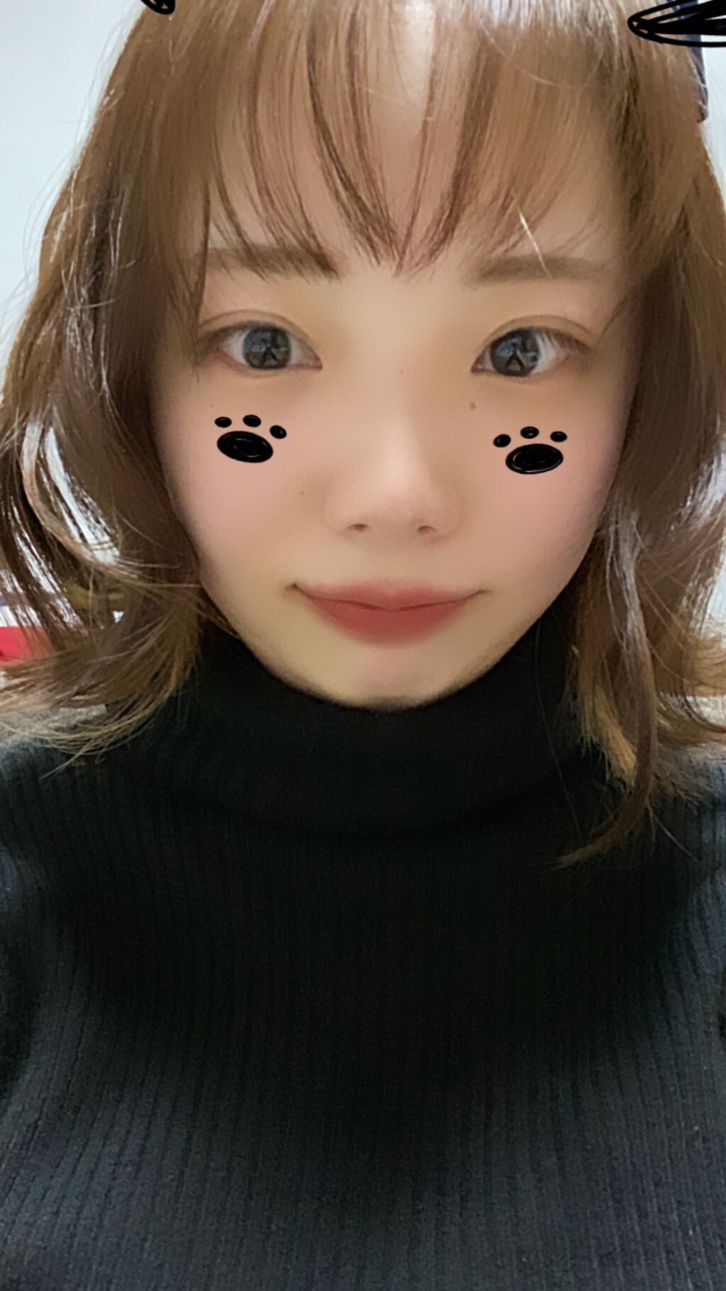 薬用オルリッチ/エクスボーテ/乳液を使ったクチコミ（3枚目）