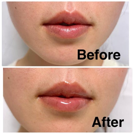 NRライスモスヒアクエンチリップオイル〈リップトリートメント〉/パンピューリ/リップオイルを使ったクチコミ(2枚目)